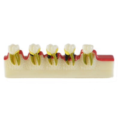 China Dental Caries Developing model / Dental Medical Teeth Teaching Model supplier