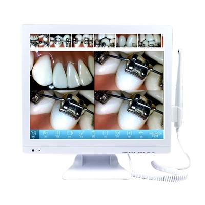 China Touch Screen Dental Camera with Android System and Dental Unit Holder supplier