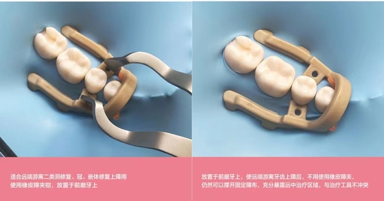 Dental Rubber Dam Clamp / Dental Restorative Instruments/Distal-extension dental dam clamp supplier