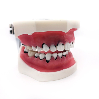 Dental Medicine Science Education Model Practice Human Teeth Oral Model Periodontal Disease Model supplier