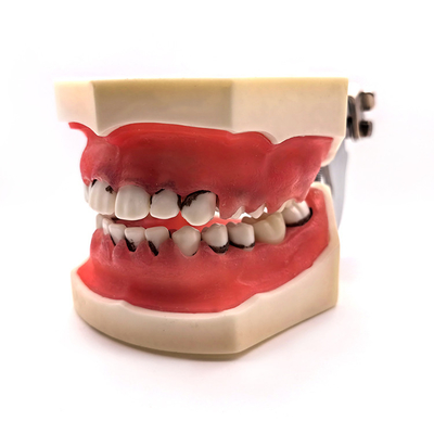 Dental Medicine Science Education Model Practice Human Teeth Oral Model Periodontal Disease Model supplier